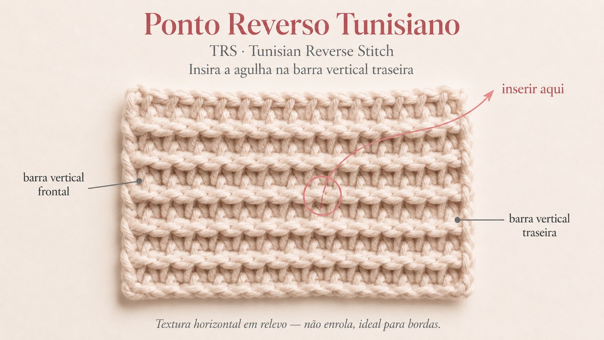Diagrama do Ponto Reverso Tunisiano (TRS) — onde inserir a agulha na barra traseira